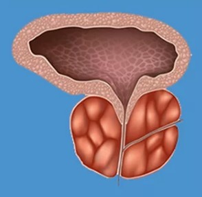 Karakteristike prostatitisa