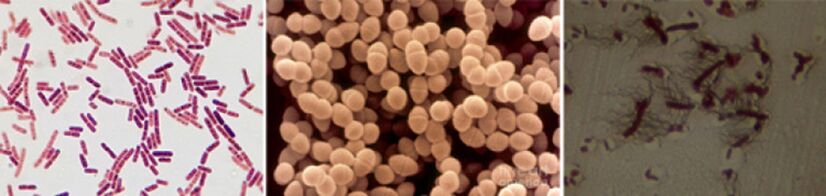 E. coli, fekalni enterokok i proteus glavni su uzročnici kroničnog bakterijskog prostatitisa