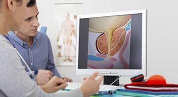 dijagnosticiranje prostatitisa u muškarca