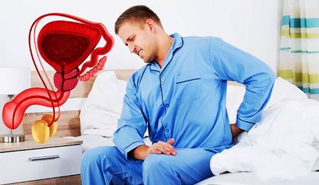 bol u donjem dijelu leđa zbog prostatitisa